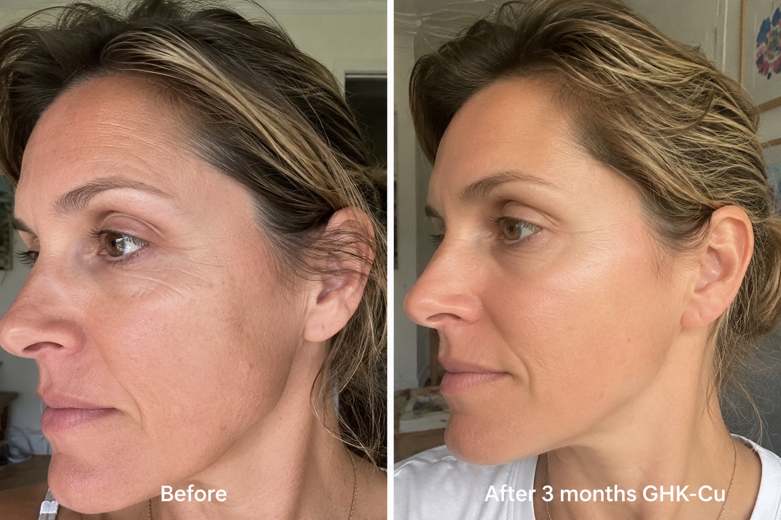 GHK-Cu before and after, three month journey showing skin firmness, tone and texture
